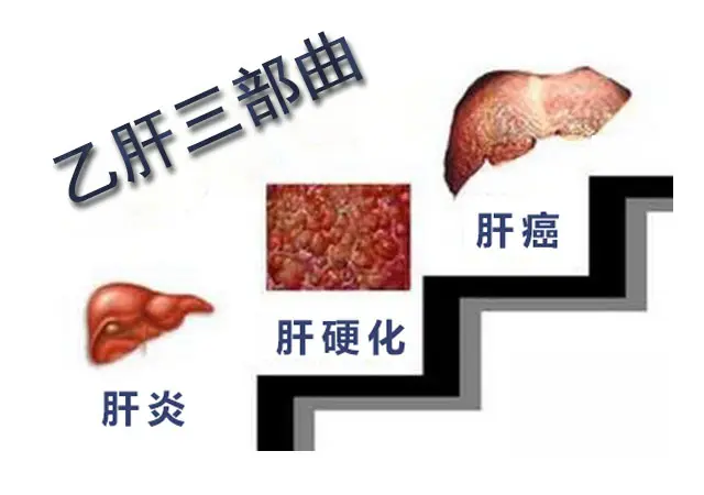 健康人感染乙肝的幾率是多少？